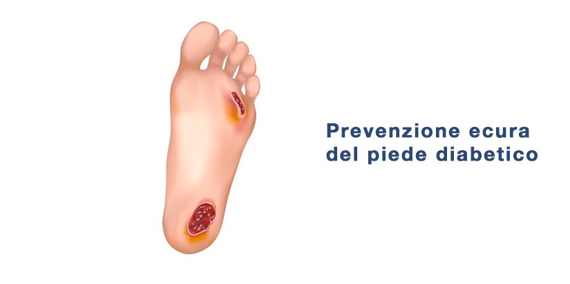 Prevenzione e cura del piede diabetico