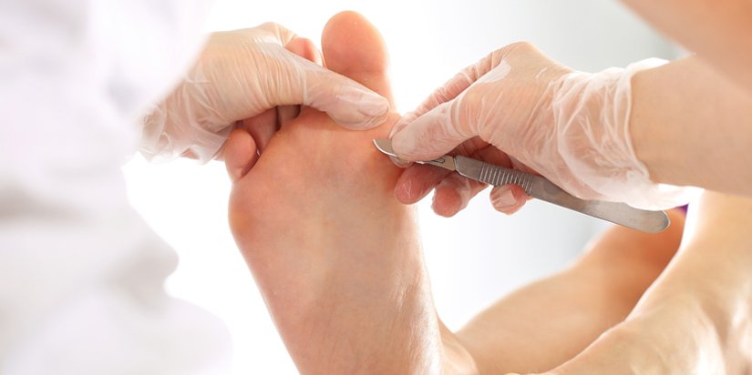 trattamenti podologici bisceglie